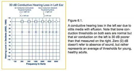 Hearing Loss