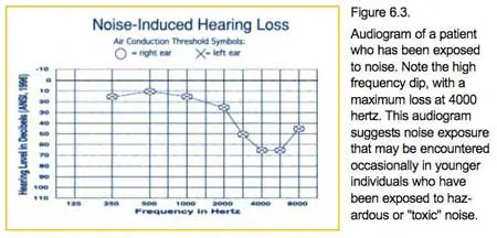 noise-induced hearing loss