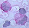 Stem Cells in Mice Lead to New Cochlear Hair Cell Growth
