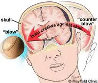 Head and Neck Injuries Cause Tinnitus