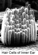An image of hair cells in the inner ear.