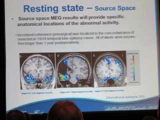 AAO-HNSF International Tinnitus Mini-Seminar – 2012