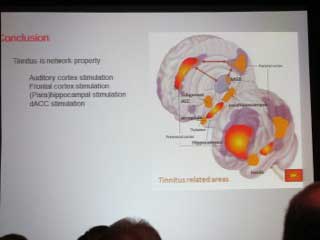 AAO-HNSF International Tinnitus Mini-Seminar – 2012
